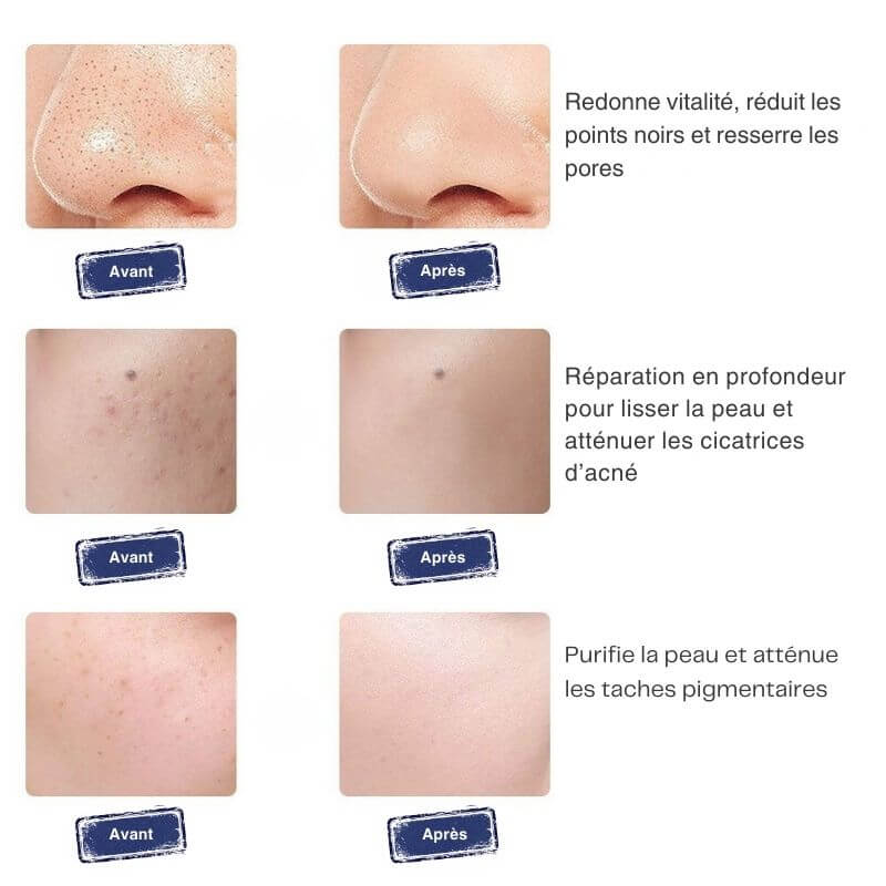 Masque LED 7 couleurs – soin visage anti-taches & éclat