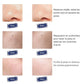 Masque LED 7 couleurs – soin visage anti-taches & éclat